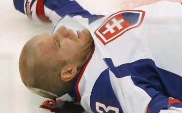 Бартечко се подобрява след мозъчното сътресение