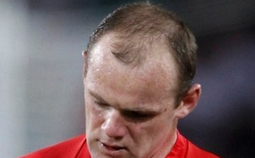 Бащата на проститутката на Рууни получи удар