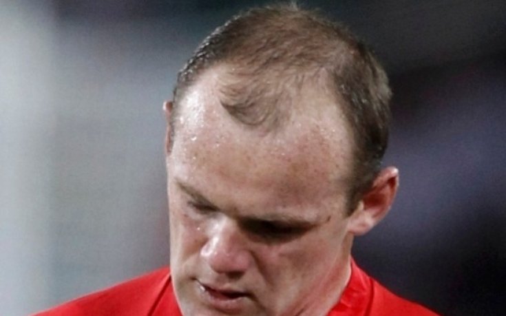 Бащата на проститутката на Рууни получи удар