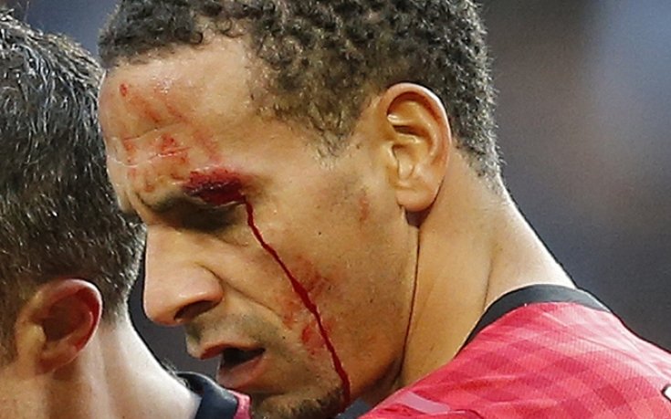 ВИДЕО И СНИМКИ: Ексцесии на дербито на Манчестър