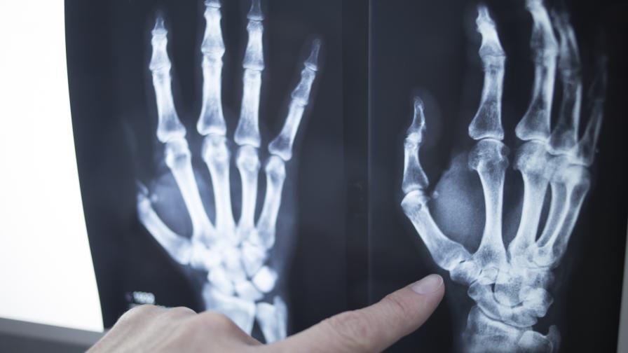 Хакери атакуват рентгени и медицинска апаратура