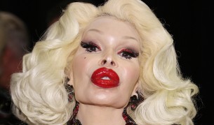 5 звезди с шокиращи пластични операции (видео)