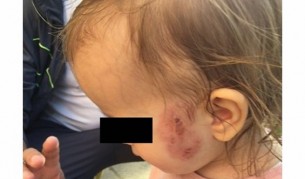 Дете нахапа зверски друго в ясла. Но само това ли е?