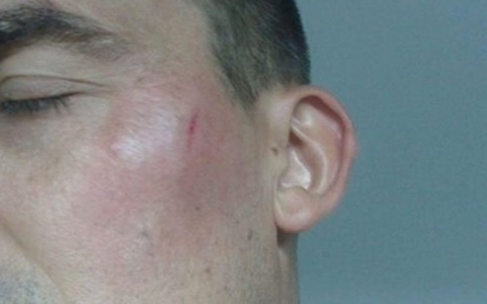 Хаос: Удариха съдия с шише ракия в Босна