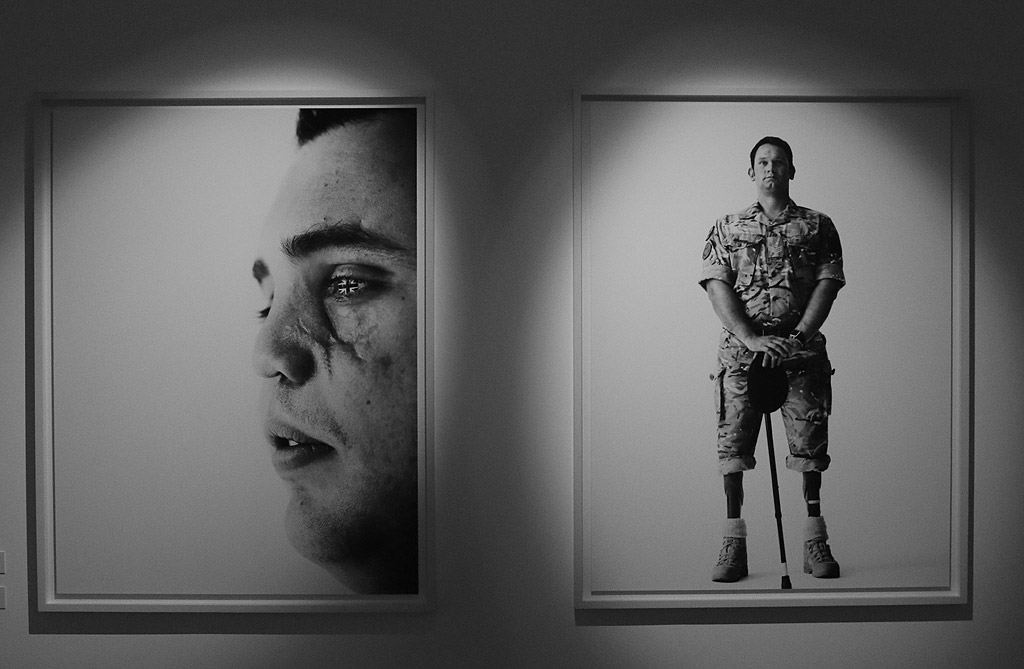 Експозицията включва две фотографски серии на Адамс: "Ранени" (Wounded), която показва млади британски военни, претърпели тежки травми по време на мисиите в Ирак и Афганистан, и "На фокус" (Exposed), в която пред обектива му застават знаменитости като кралица Елизабет, Мик Джагър, Дъстин Хофман, Стинг, Ейми Уайнхаус, Моника Белучи, Кейт Мос, Виктория Бекъм, Шон Пен и много други.