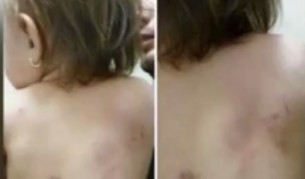 Ужасена майка - детето ѝ зверски нахапано