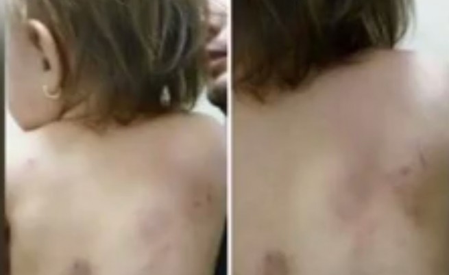 Ужасена майка - детето ѝ зверски нахапано