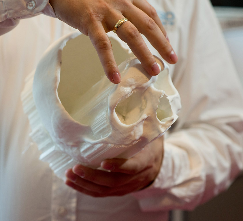 Презентация на най-новото 3D принтерно оборудване в Bionanopark в Лодз, Централна Полша. Принтерът Ultimaker 3 може да отпечата костни импланти от водоразтворими материали. 3D костното печатане дава на лекарите възможността да произвеждат персонализирани, анатомично точни импланти за определен пациент.