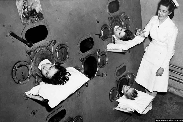  Въпреки че здравната процедура на фотографията е напълно съответна и потребна, машината, от която се подават три детски глави, наподобява като от черно-бял холивудски филм на ужасите. Снимката е снимана през 1950 година На нея се виждат три деца в смесен „ стоманен бял дроб “. Тази технология се употребява, с цел да разреши на пациента да диша, когато тялото му е изгубило мускулната дарба да прави жизненоважната активност. 