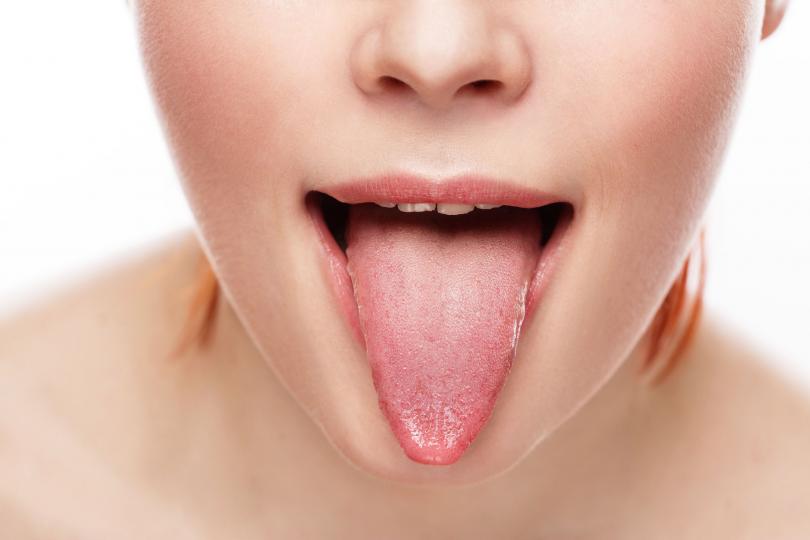 <p><strong>Жълт език</strong></p>

<p>Както и при черния език, това също е резултат от задържане на бактерии. Папилите могат да се раздразнят, ако са дехидратирани, когато дишаш през устата вместо през носа или ако страдаш от треска или пушиш твърде много.</p>

<p>Решението и тук е добрата устна хигиена.</p>