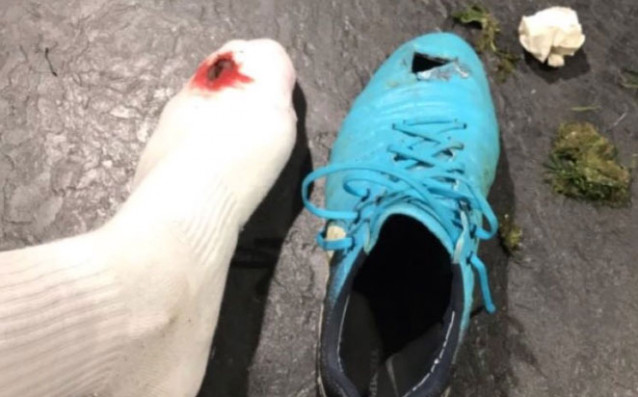 Защитникът на Челси Антонио Рюдигер показа ужасяваща контузия след мача