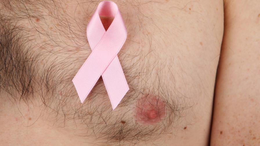 Ракът на гърдата се среща и при мъжете