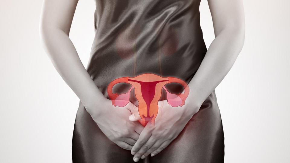 Важно за всички жени: фатална ли е ендометриозата