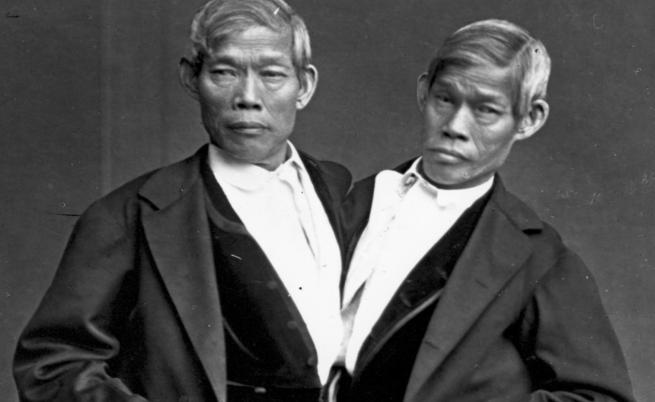 Странната история на оригиналните сиамски близнаци