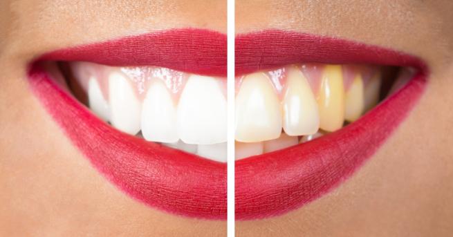 Повечето хора са наясно че е необходимо да се грижим