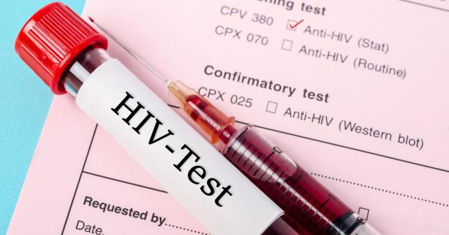 Пробив в лечението срещу вируса на СПИН Става въпрос за