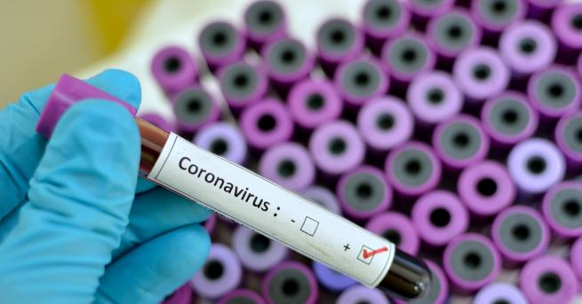 България Отрицателни са пробите на всички изследвани за коронавирус в