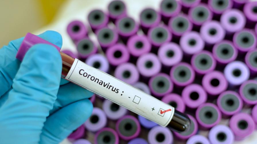 Отрицателни са пробите на всички изследвани за коронавирус в България