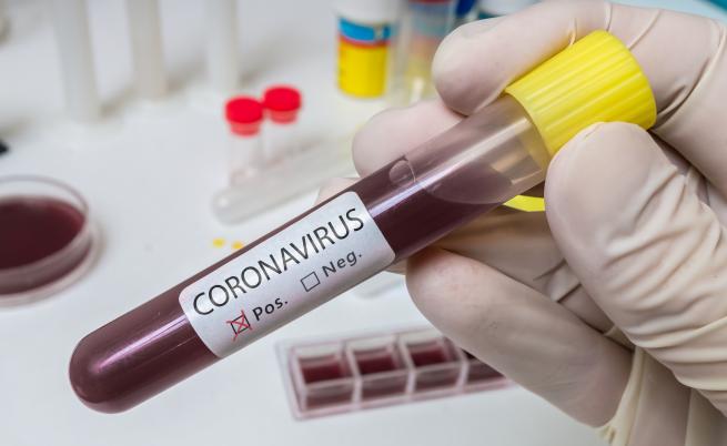 Испански специалист: Лекарите знаят как да се справят с коронавируса