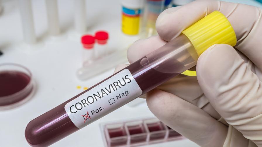 Коя е най-честата причина за смъртта при коронавирус