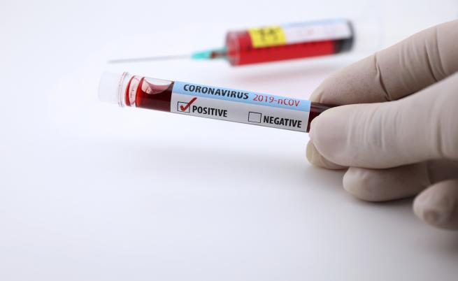 ЕС дава 140 млн. евро за разработване на ваксина срещу COVID-19