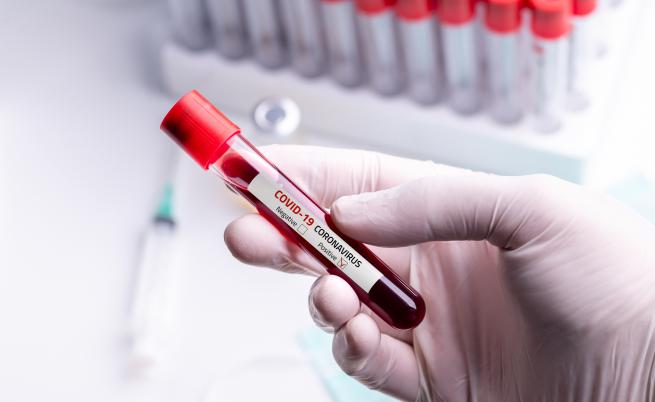  Доказателството, че коронавирусът няма по какъв начин да е основан в лаборатория 