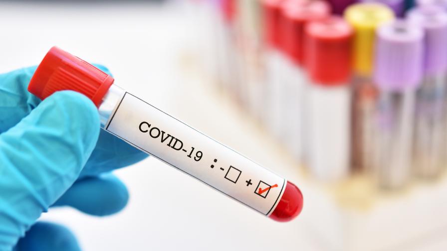159 нови случая на коронавирус у нас, 8 души са починали