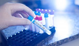 <p>Украинци, работещи по "Балкански поток" в Разградско, са с COVID-19&nbsp;&nbsp;</p>