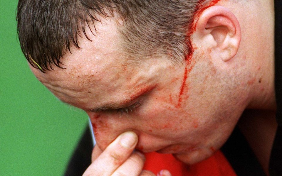 Бивш нападател на ЦСКА строши носа на съдия, изхвърлиха го от футбола