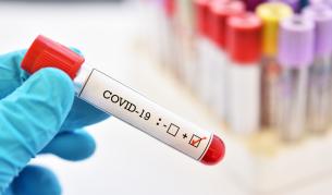 Covid-19: Стоматолог с важен съвет