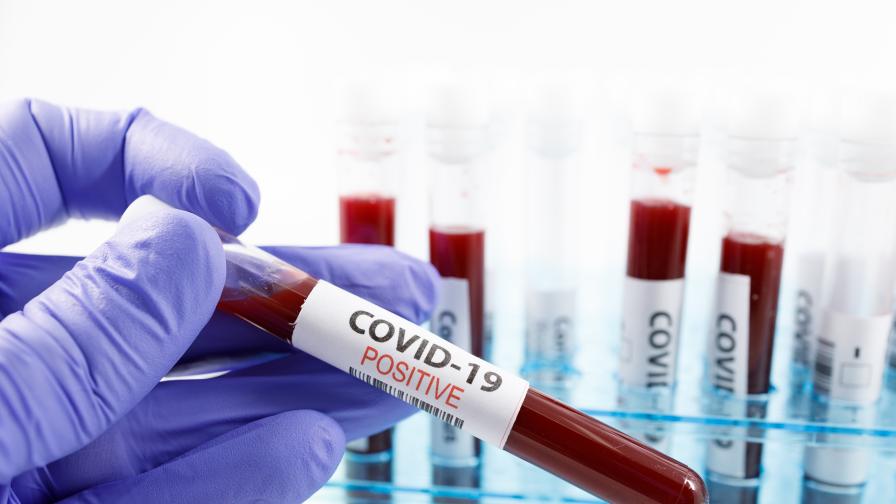 Близо 1500 нови случая на COVID-19, има починали