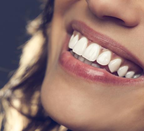 Белите зъби са много важна част от външния вид Всички