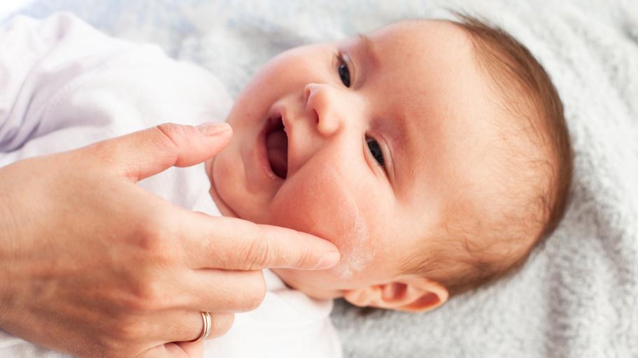 Контактен дерматит при бебе - как копче, балон и дори играчка могат да причинят болка и рани