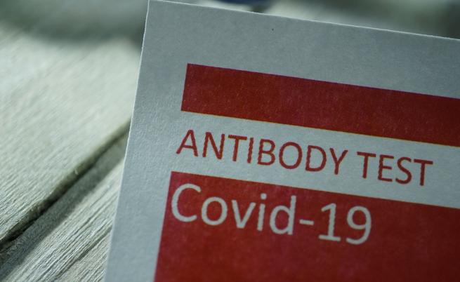 Колко антитела са нужни, за да сме защитени от COVID-19