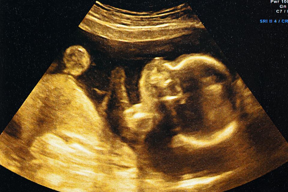 бременна жена бременност ултразвук снимка бебе