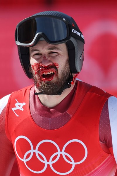 Кръв оплиска Олимпиадата Даниел Хеметсбергер1