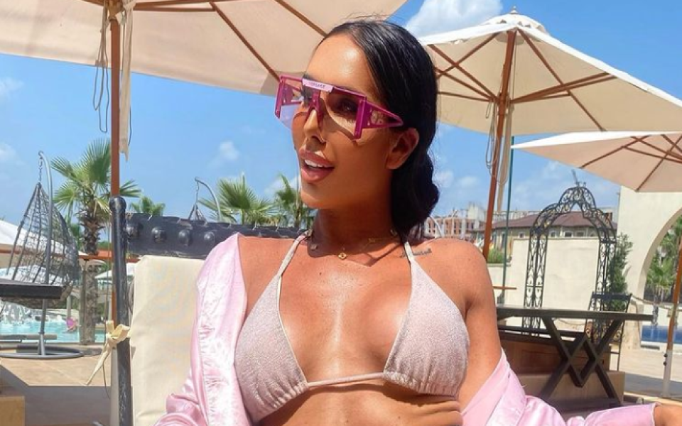 Красавицата никога не е крила, че има хиалурон в устните,