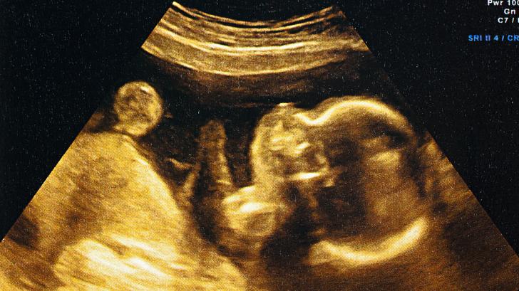 Невероятно: 10 неща, които бебетата научават още в утробата