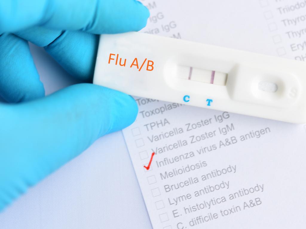 Доказани са първите за сезона грипни вируси A H1N1 pdm09 съобщават на