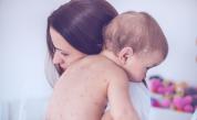 Ваксината срещу варицела вече е задължителна в България – какво трябва да знаят родителите