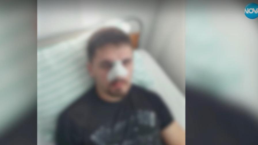 Баща твърди, че синът му е нападнат и пребит от полицаи в Плевен