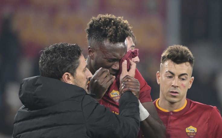 Ейбрахам под въпрос за реванша със Залцбург заради операция на окото