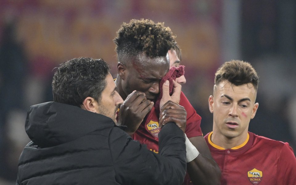 Нападателят на Рома Тами Ейбрахам разкри, че може да пропусне