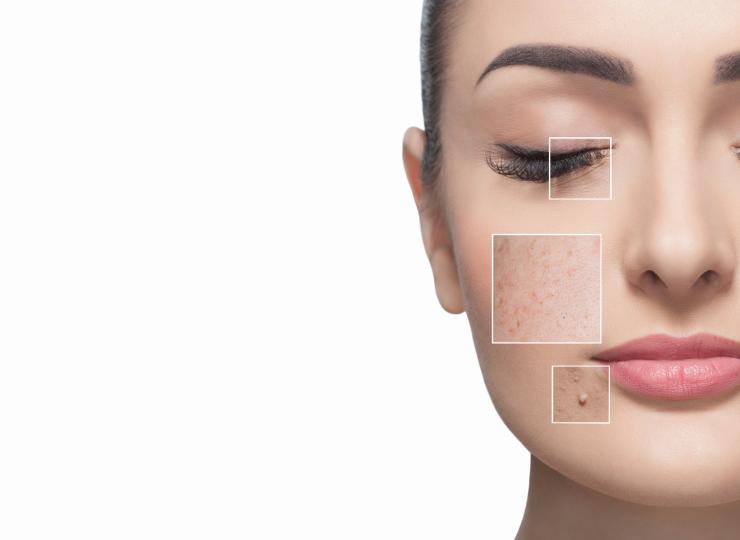 <p align="left"><b>Предпазване на кожата отвътре навън</b><br />
Излагането на слънце може да ви придава любимия загар през лятото, но всички знаем, че ултравиолетовите лъчи могат сериозно да увредят кожата ни. В допълнение към хиперпигментацията, проучванията показват, че излагането на слънчеви UV лъчи може да причини намаляване на еластичността на кожата и ранни признаци на стареене. Дори и да не сте на плажа, имате нужда от защита срещу тези лъчи, предизвикващи бръчки. Слънцезащитните кремове за лице (и повторното им нанасяне през деня) е от ключово значение, а се оказва, че можете да се борите с ултравиолетовите лъчи и отвътре навън. Мощни антиоксиданти и фитонутриенти като Polypodium Leucotomos и куркума могат да предпазят кожата ви.</p>