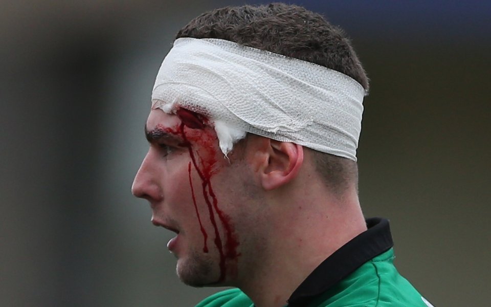 Датският защитник на турския Галатасарай – Виктор Нелсон, изуми с