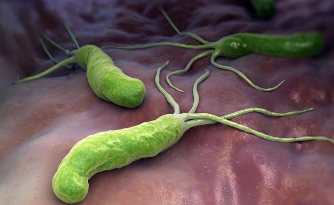 20 години в организма: Разяждаща стомаха бактерия причинила рак и довела до смъртта на мъж
