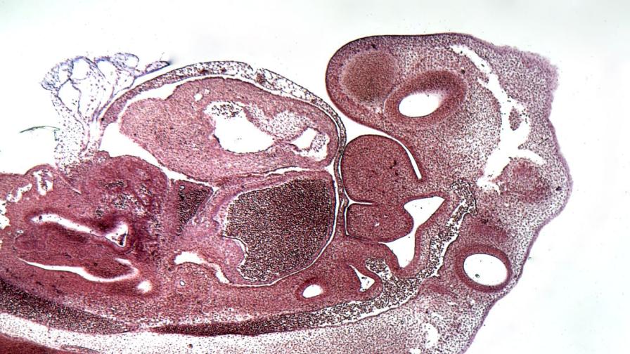 Учени отгледаха бъбреци с човешки клетки в ембриони на прасета