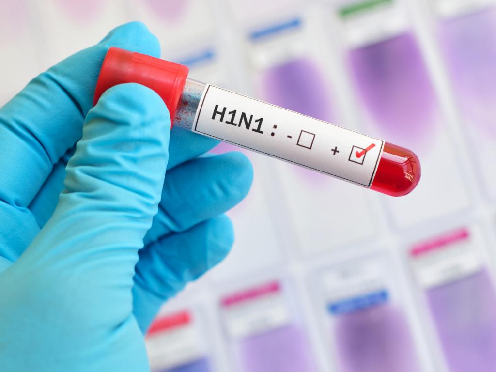 Във Великобритания беше установен първият случай при човек на свински грип