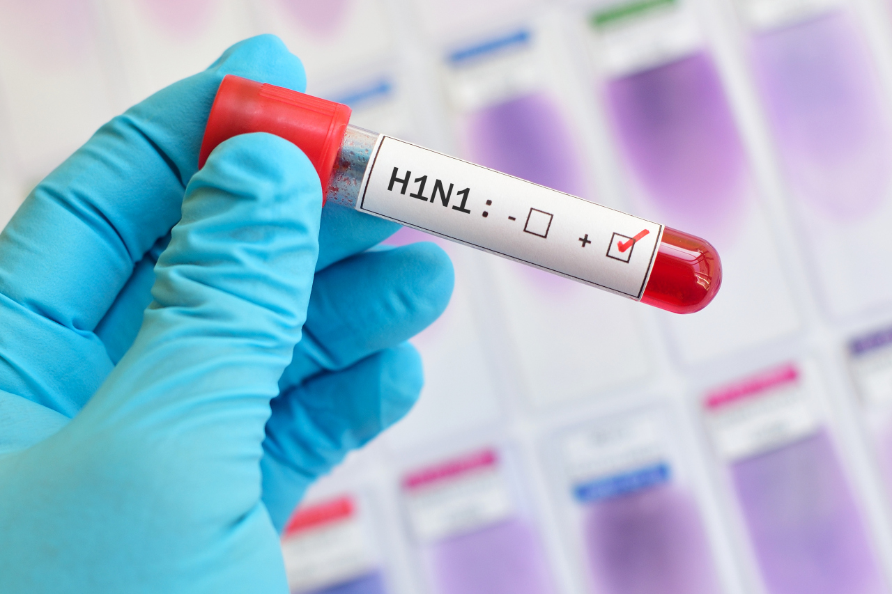 11 юни: Генерална репетиция за ужаса - как H1N1 промени света за часове