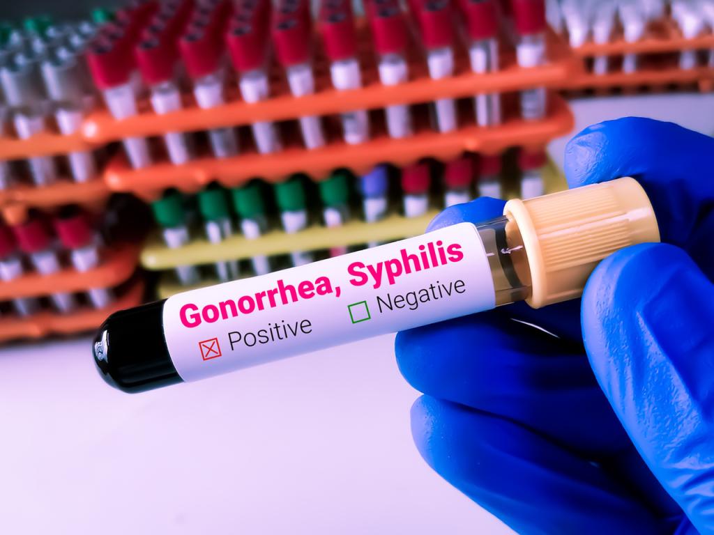 Случаите на сифилис са се увеличили с над 113 а